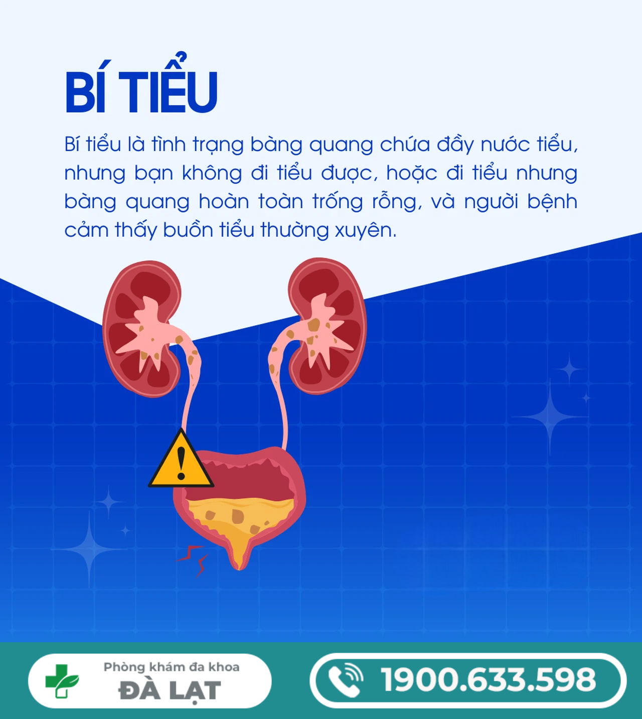 Hình ảnh minh họa